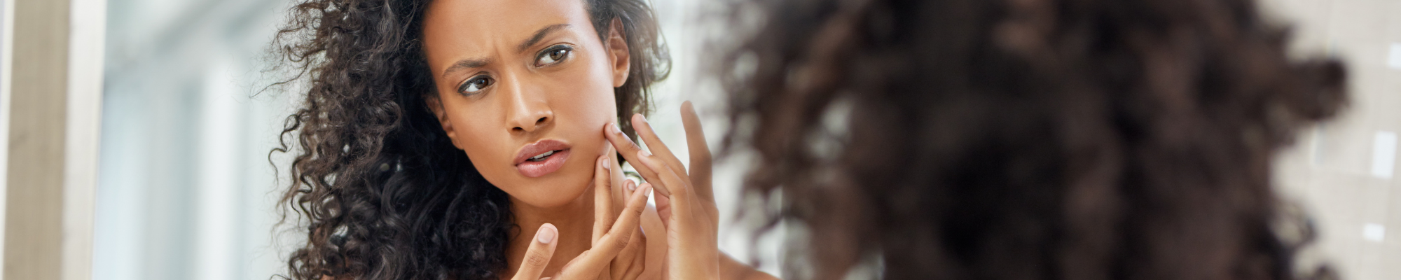 Organic Acne Cream & 13 Pro Skincare Tips for Acne Prone Skin